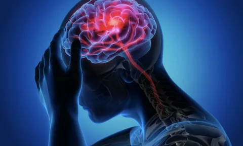 Những thời điểm dễ đột quỵ nhất