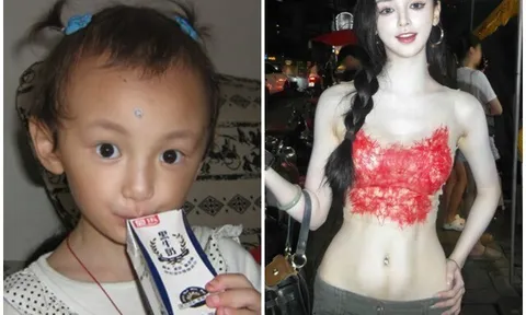 Bé gái câm điếc thành hoa khôi trường đại học, bị nghi ngờ PTTM vì mặt đẹp hoàn hảo không chỗ chê