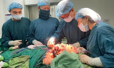 Phẫu thuật cứu sống cụ bà mang khối u máu khổng lồ trên mặt hơn 50 năm