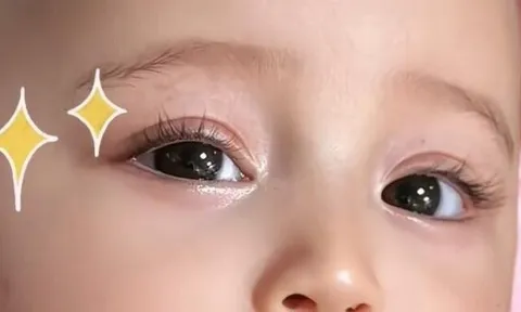 Bé gái sơ sinh có khuôn mặt đẹp như tiên tử, cõi mạng trầm trồ “đứa trẻ đã phẫu thuật thẩm mỹ”