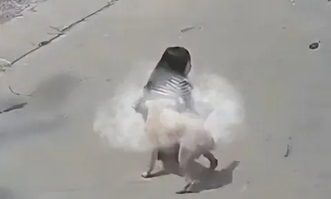 Bé gái 5 tuổi bị chó nhà hàng xóm bất ngờ tấn công, húc ngã xuống đất khi đi bộ trên đường, phải nhập viện gấp