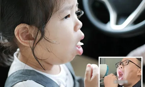 Trẻ bị hóc xương cá, bác sĩ khuyên cha mẹ nhanh chóng cho thêm một thứ vào miệng con nhưng không được nuốt