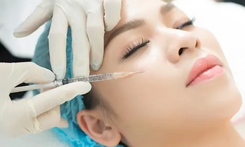 Những hệ lụy từ việc tiêm filler mà có thể bạn chưa biết