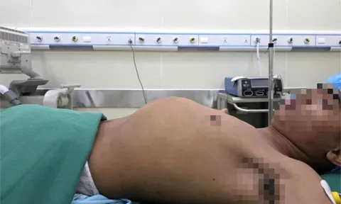 Thanh niên bị "bệnh lạ", tỉ lệ 1/1.000 người mắc