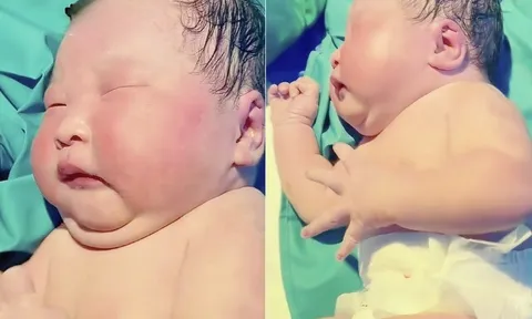 Bé sơ sinh chào đời nặng 9kg, cổ mất hút, bác sĩ đỡ đẻ lắc đầu: “Đứa bé này như trẻ 1 tuổi”