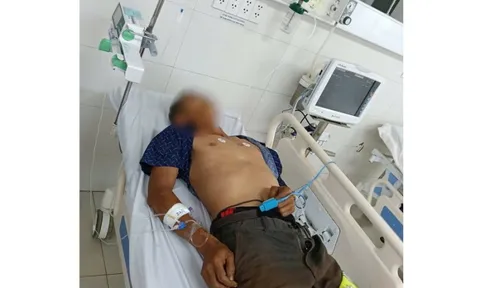 Ngộ độc sau khi ăn bọ xít, một bệnh nhân nguy kịch