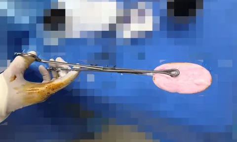 Bé gái đi cấp cứu vì nhét xà phòng vào vùng kín lúc đang tắm