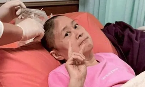 Diễn viên Vương Nguyệt 'Vườn sao băng' ngã chấn thương, mất một phần hộp sọ