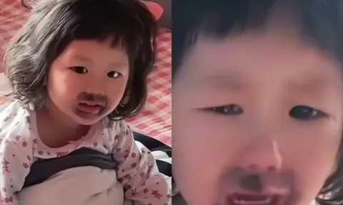 Bé gái 4 tuổi ngủ dậy khóc thét vì miệng “mọc” đầy vết đen lạ, nguyên nhân từ món ăn yêu thích mỗi ngày