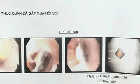 Bác sĩ cảnh báo một tai nạn nguy hiểm dễ gặp ở người già
