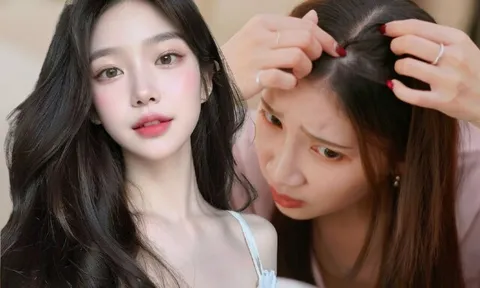 Tóc rụng liên tục, ngày càng mỏng, chuyên gia bật mí 10 thói quen “cứu nguy” giúp tóc con mọc lên tua tủa