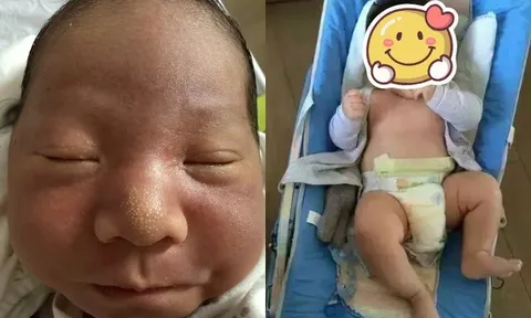 Rời bàn đẻ, mẹ bỉm bật khóc khi thấy con sơ sinh chào đời quá xấu, 3 tháng sau hãnh diện khoe khắp MXH