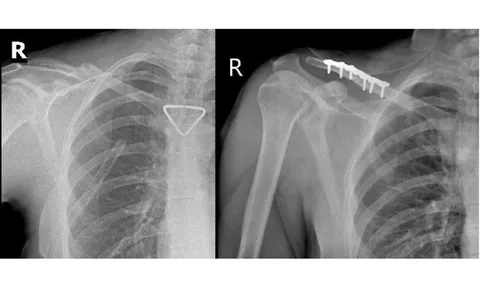 Thêm 1 du khách người Nga được bác sĩ cấp cứu kịp thời