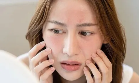 3 bước chăm sóc da nên tạm ngưng trong dịp Tết