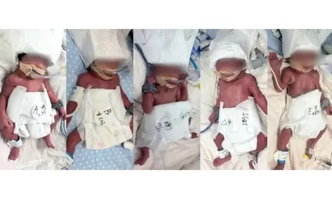 Người phụ nữ 24 tuổi sinh 5 hiếm gặp