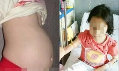 Bé gái 10 tuổi ôm bụng nói có "em bé", người mẹ hối hận bật khóc khi nghe bác sĩ nói phẫu thuật gấp