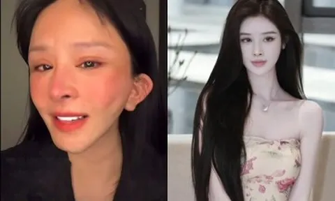 Mạng xã hội "dậy sóng" với cô gái livestream khóc lóc giữa đêm vì gương mặt biến dạng sau khi thẩm mỹ