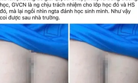 Vụ phụ huynh vào trường đánh học sinh: Tạm đình chỉ 2 giáo viên