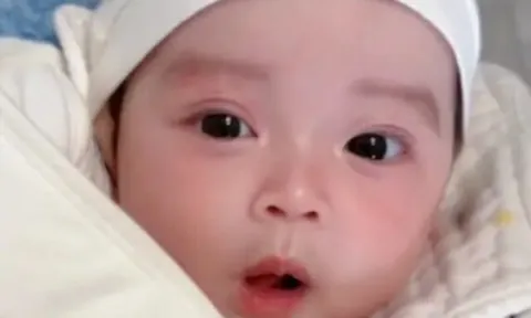 Bé sơ sinh chào đời toàn thân phủ màu trắng, 3 ngày sau nổi tiếng cả bệnh viện vì xinh như thiên thần