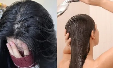 Gội đầu mỗi ngày sao tóc vẫn nhanh bết? 5 thói quen khiến tóc nhanh đổ dầu, đặc biệt cẩn thận với 2 kiểu dầu gội