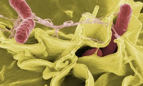 TPHCM: Tình trạng học sinh nghi ngộ độc thực phẩm tại Trường Bình Quới Tây hiện ra sao?