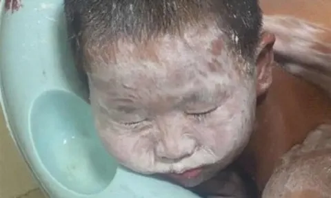 Mẹ phát hiện con trai đi tắm mãi vẫn chưa ra, vào kiểm tra thì hoảng hốt thấy mặt con trắng bệch