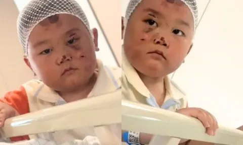 Bé trai 3 tuổi mặt đầy vết thương túc trực chăm mẹ nằm giường bệnh, câu chuyện phía sau ai nghe cũng nghẹn lòng