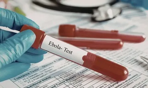 TPHCM tăng cường giám sát cửa khẩu, chủ động phòng nguy cơ dịch bệnh Ebola xâm nhập