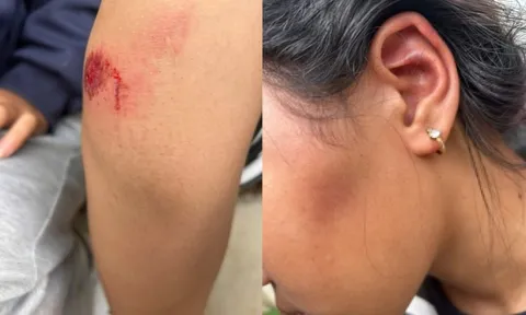 Nữ sinh lớp 6 bị đánh hội đồng, bắt quỳ dưới nắng, lau chân