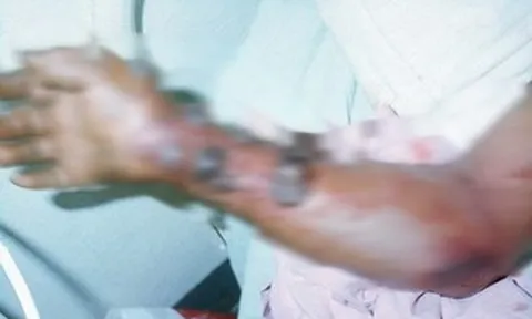Vì sao WHO đánh giá nguy cơ Ebola vào Việt Nam ở mức thấp?
