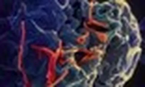 Bộ Y tế đánh giá về nguy cơ dịch Ebola đối với Việt Nam