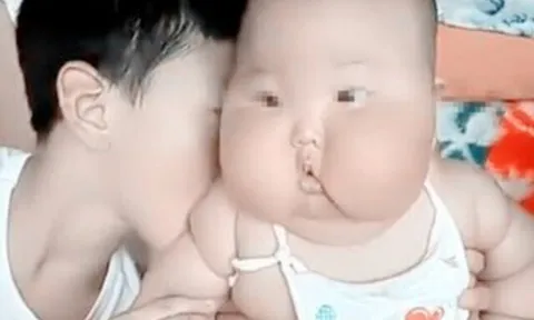 Từng là cô bé xinh xắn, con gái đổi khác sau 6 tháng ở quê ông bà nuôi, người mẹ "sốc lên sốc xuống"