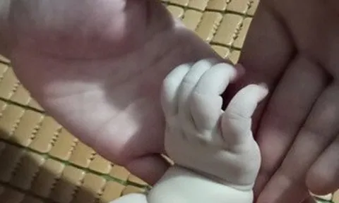 Người đàn ông hiếm muộn do Klinefelter làm cha sau 7 năm