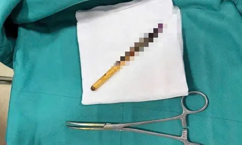 Công an vào cuộc vụ phụ huynh tố con bị bạn nhét bút vào hậu môn