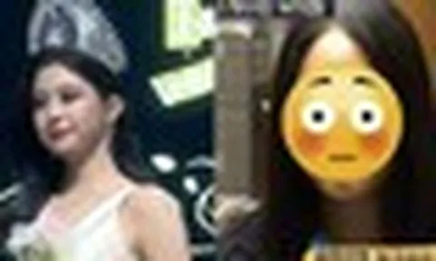 Hoa hậu bị "đào" loạt ảnh quá khứ, dân mạng chỉ trích "dao kéo" quá đà không xứng đăng quang!