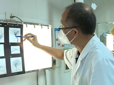 Mù mắt, co giật, tắc động mạch não vì tiêm filler làm đẹp mũi