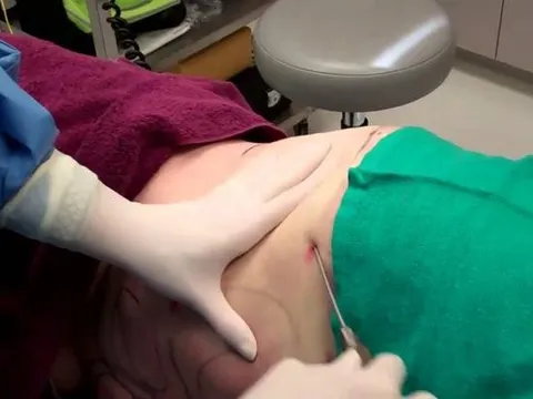 Vụ hút mỡ bụng tử vong: 'Không có sai sót chuyên môn'