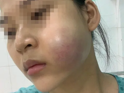 Bỏ tiền triệu 'nâng cấp sắc đẹp', thiếu nữ 'nhận' về gương mặt biến dạng