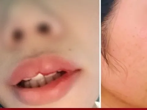 Xử phạt hành chính thầy giáo xông vào nhà hành hung nữ đồng nghiệp ở Đắk Nông