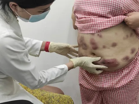 Quý bà 'tan nát' cơ thể vì mê làm đẹp cấp tốc