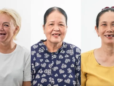 Nha khoa Plan cấy implant miễn phí cho năm người khó khăn