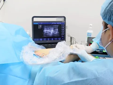 Hậu quả khi điều trị suy giãn tĩnh mạch cấp độ 2 không đúng phác đồ