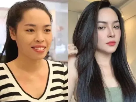 Nhan sắc hiện tại của hot girl từng "lột xác" nhờ phẫu thuật thẩm mỹ
