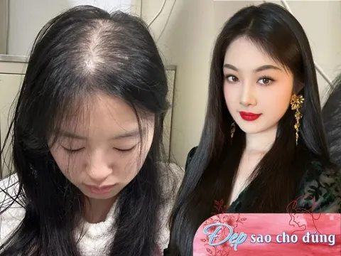 Tóc mọc chậm mãi không dài lại hay rụng nhiều, thử ngay bí quyết giúp tóc dài gấp đôi trong 1 tháng của gái Hàn