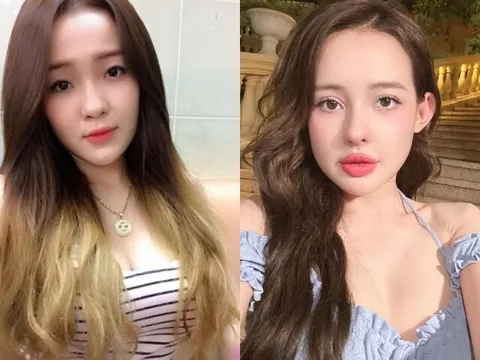 10 năm qua, Ngân 98 từng "nghiện" phẫu thuật thẩm mỹ ra sao?