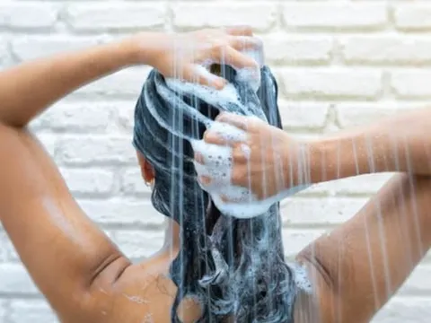 Những thói quen tưởng vô hại lại khiến da đầu bị tổn thương