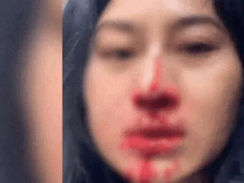 Diễn viên Phi Ngọc Ánh hoảng loạn cầu cứu