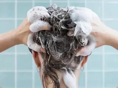 8 dấu hiệu cho thấy bạn cần gội đầu thường xuyên hơn