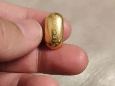 Con trai 11 tuổi nuốt hạt đậu vàng 10g, mẹ 'khóc dở mếu dở' suốt 5 ngày