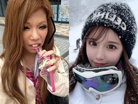 Cô gái "vịt hóa thiên nga" sau khi chi 4 tỷ cho hơn 20 cuộc phẫu thuật, nhan sắc trước và sau thẩm mỹ khó tin nổi